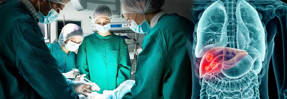 What Are The Different Types of Liver Transplant Surgeries in India?